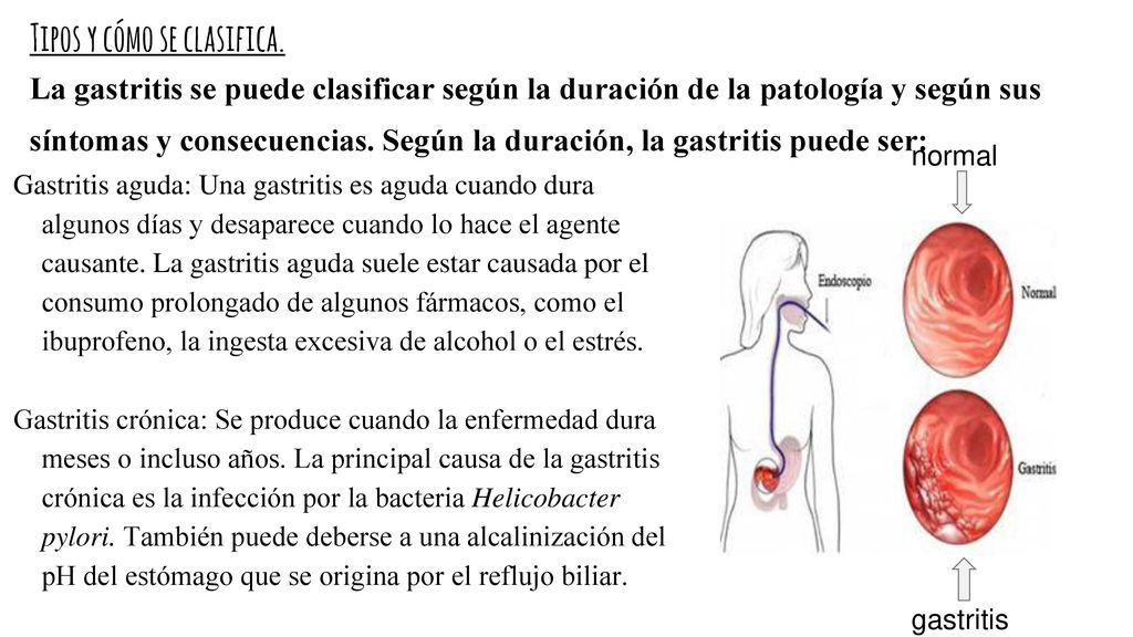 Aguda que gastritis sintomas la es